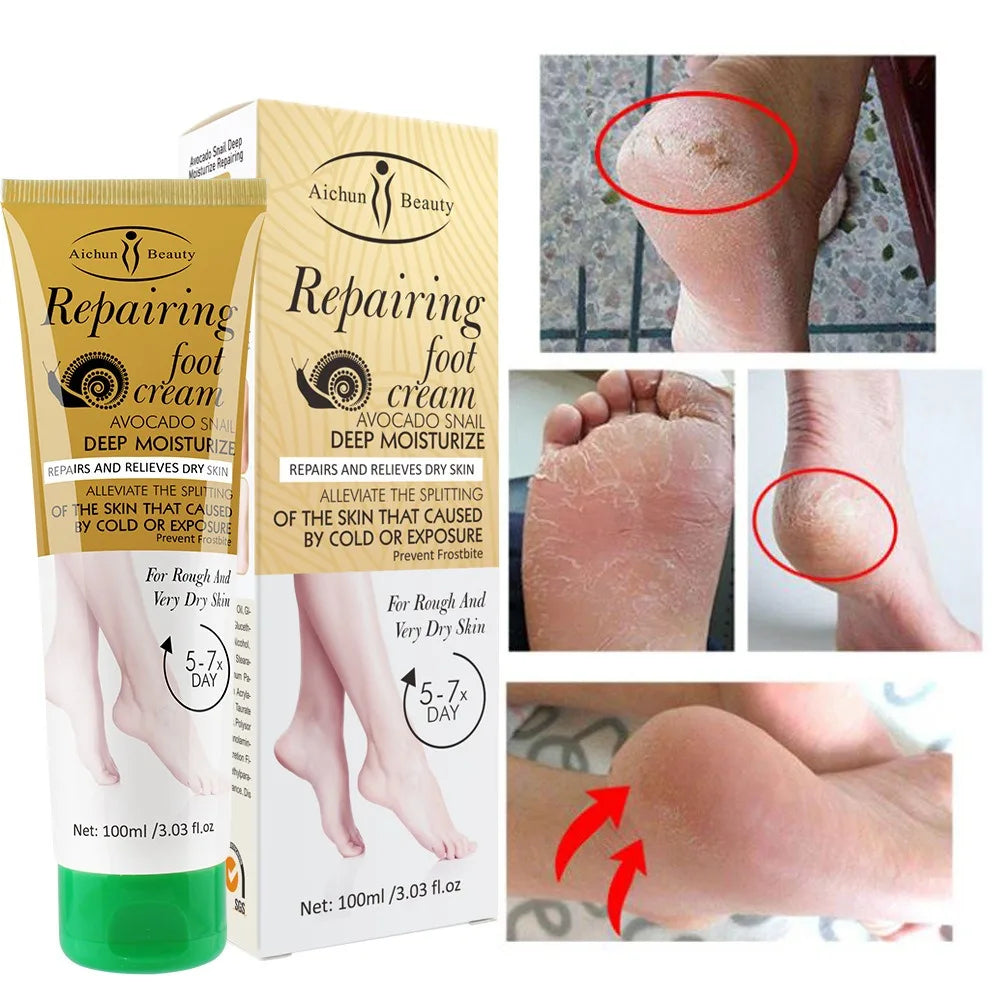 Foot Cream Snail Mucus Extract Anti-chafing Remove Dead Skin Moisturizing Anti-crack Whitening Smooth Skin Foot Skincare